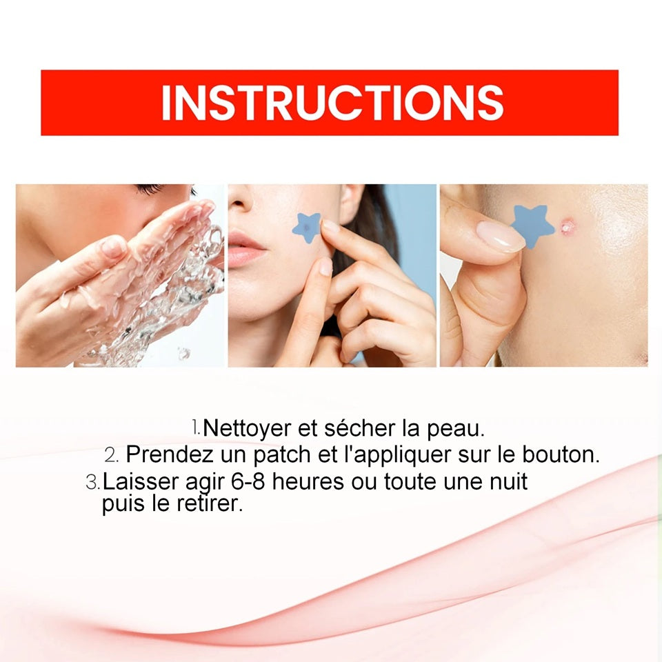 Patchs anti-Acné en Forme d'Étoiles – Image 3